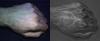 Comparison of fist: image taken with a normal camera (left), HyperCam images (right)